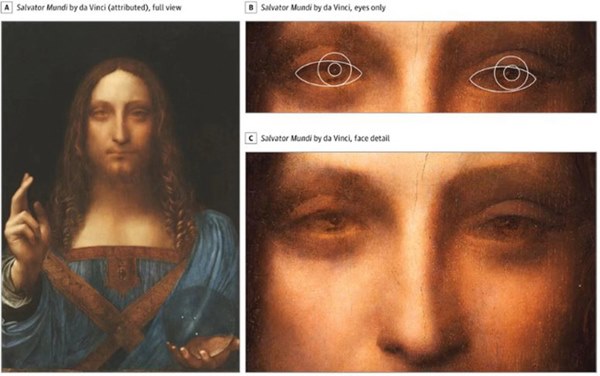 Giả thiết về căn bệnh lạ giúp danh họa Leonardo da Vinci tạo ra các tuyệt tác hội họa vĩ đại-3