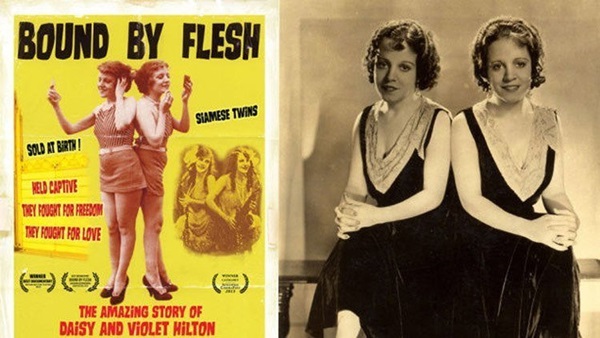 Cặp song sinh dính liền hơn 100 năm trước: Lấy chồng, đến già vẫn cô đơn-4