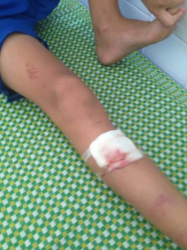 Thanh Hóa: Bênh cháu, cô giáo mầm non đánh trọng thương bé trai 13 tuổi-2