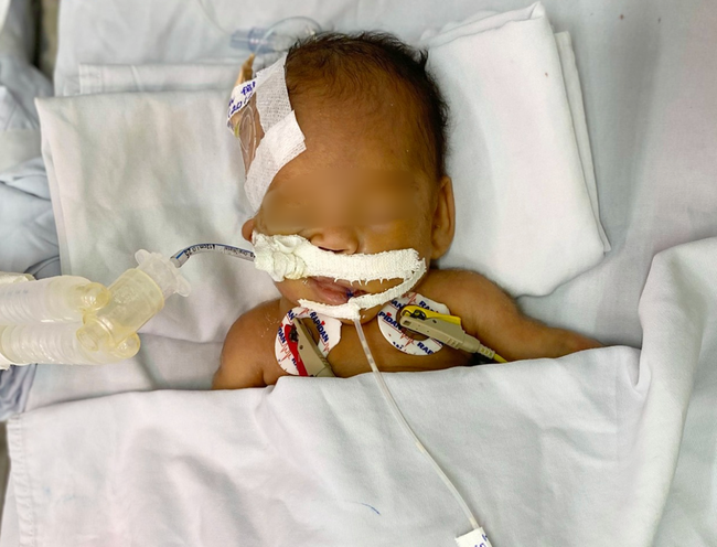 Thương tâm: Bé trai sơ sinh nặng chỉ 1,4kg bị bỏ rơi trước cổng chùa, mắt lồi, người đầy vết tiêm chích-1