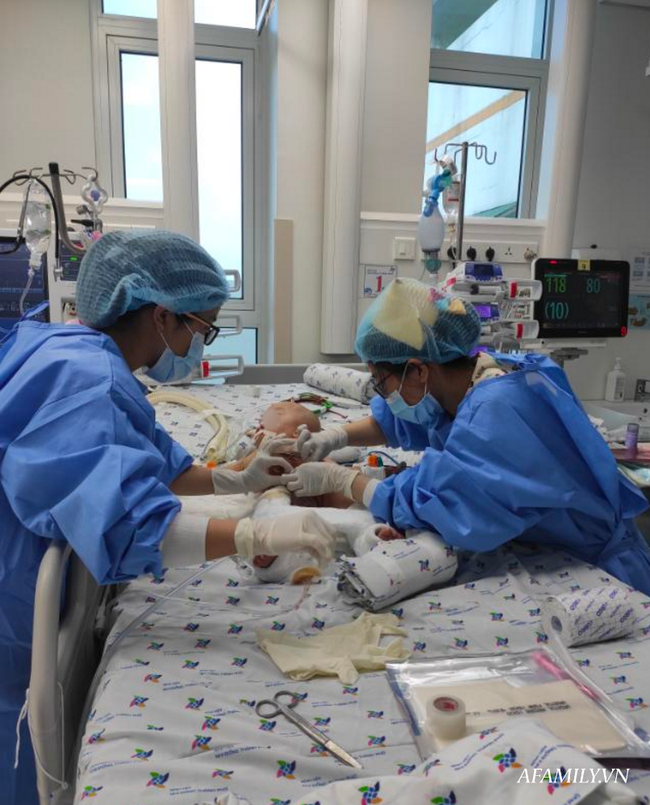 Trúc Nhi và Diệu Nhi được theo dõi sức khỏe thế nào trong phòng chăm sóc đặc biệt sau mổ?-1