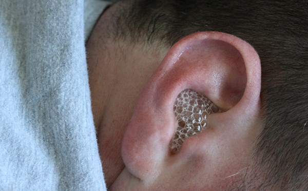 Con thối tai vì mẹ tự chữa viêm tai giữa: Bác sĩ khuyến cáo những cách chữa bệnh sai lầm-1