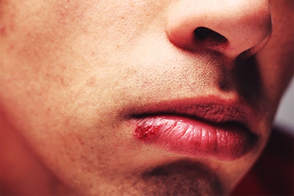 Vị trí xoa bóp trên bàn tay có thể giúp ngăn chặn 7 bệnh ai cũng sợ mắc phải-4