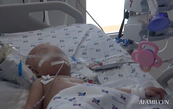 Chứng nhân” của 6 ca tách dính tại Việt Nam kể lại khoảnh khắc căng não chia đại tràng cho Trúc Nhi – Diệu Nhi-2