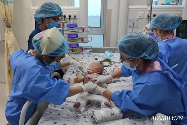 Chứng nhân” của 6 ca tách dính tại Việt Nam kể lại khoảnh khắc căng não chia đại tràng cho Trúc Nhi – Diệu Nhi-3