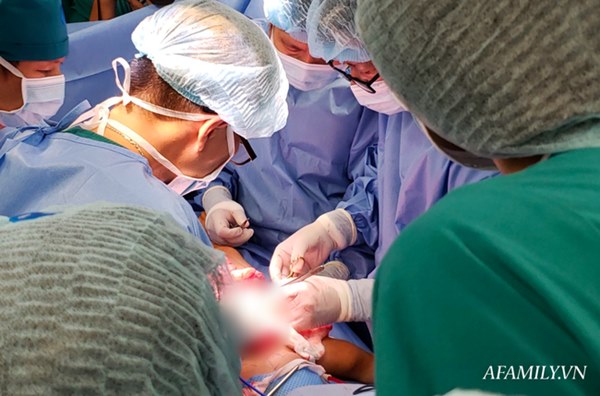 Chứng nhân” của 6 ca tách dính tại Việt Nam kể lại khoảnh khắc căng não chia đại tràng cho Trúc Nhi – Diệu Nhi-4