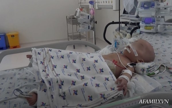 Chứng nhân” của 6 ca tách dính tại Việt Nam kể lại khoảnh khắc căng não chia đại tràng cho Trúc Nhi – Diệu Nhi-6