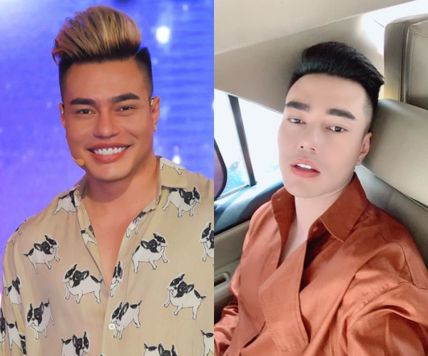 Xuất hiện nghệ sĩ nam phẫu thuật thẩm mỹ còn nhiều hơn cả chị em Vbiz-3