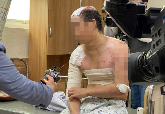Hàn Quốc: Người đàn ông bị em trai dụ đến ở chung nhà chỉ trong 2 tháng, thân tàn ma dại vì bị hành hạ, đổ nước sôi lên người-2