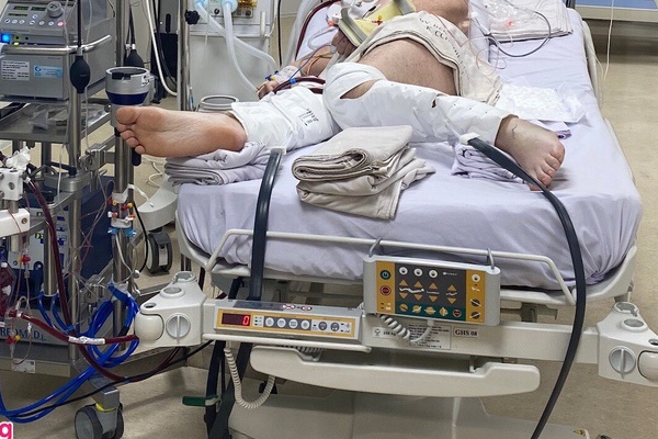 Hai bệnh nhân mắc Covid-19 ở Đà Nẵng tiên lượng rất nặng-3