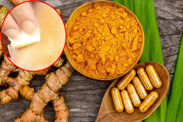 Mẹo chọn bơ dẻo ngon, không sợ tẩm thuốc gây hại-2