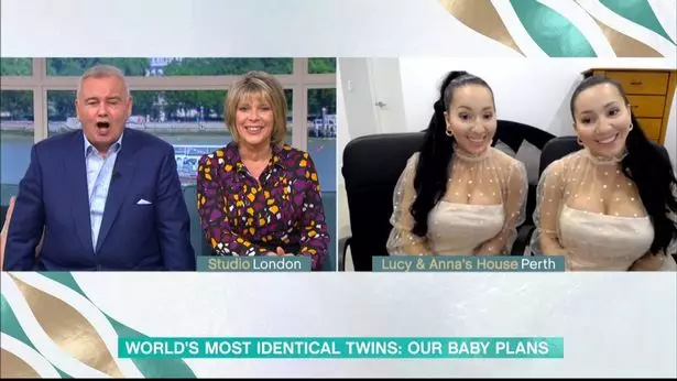 Cặp chị em phẫu thuật thẩm mỹ để giống hệt nhau vừa đòi sinh con cùng lúc với bạn trai chung-2