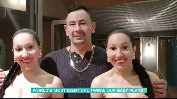 Cặp chị em phẫu thuật thẩm mỹ để giống hệt nhau vừa đòi sinh con cùng lúc với bạn trai chung-3