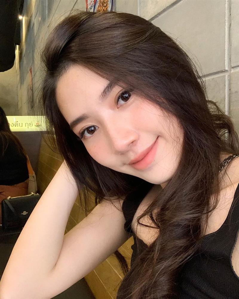 Trước khi đầu tư một lọ kem trị nám/ tàn nhang, nàng 30+ cần tìm hiểu thật kỹ 2 điều này, cẩn thận không nát mặt như chơi-1