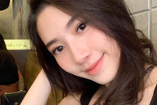 Trước khi đầu tư một lọ kem trị nám/ tàn nhang, nàng 30+ cần tìm hiểu thật kỹ 2 điều này, cẩn thận không 