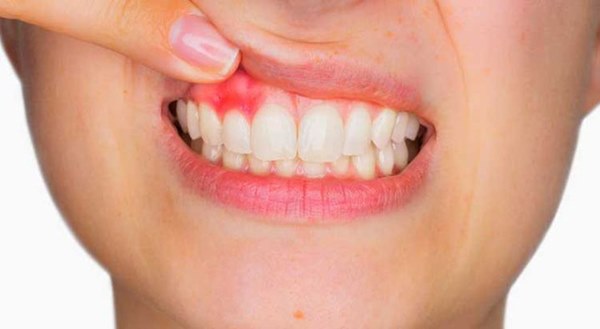 Khi bệnh gan trở thành ung thư, sẽ có 3 bất thường xuất hiện trên cơ thể-2