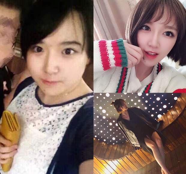 Giảm cân quá thành công, gái xinh bất ngờ bị ném đá vì nghi sống ảo-3