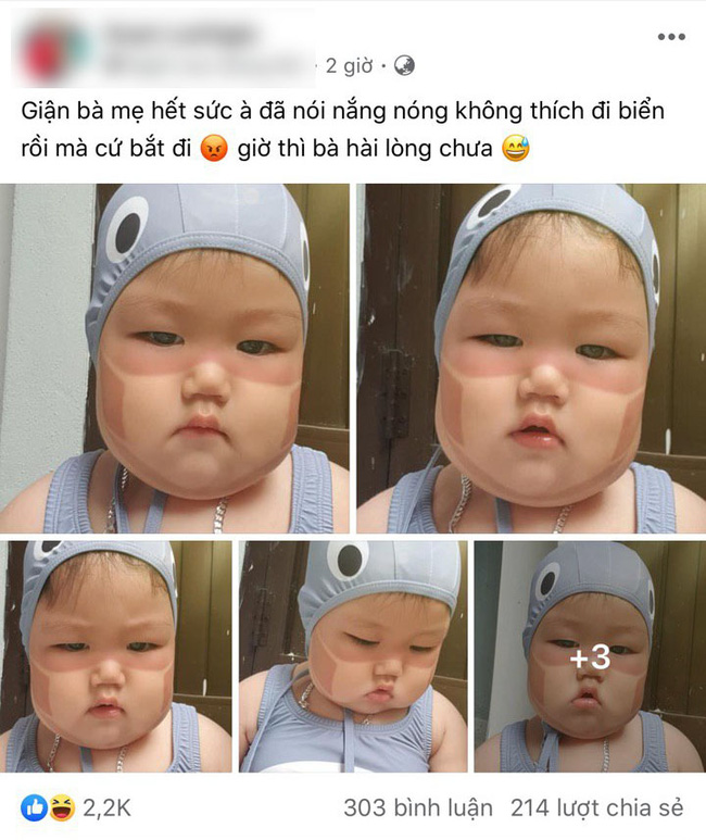 Xôn xao khắp Facebook: Xuất hiện nhiều em bé bị cháy nắng bá đạo, in hằn nguyên chiếc khẩu trang trên mặt, chuyện gì đang xảy ra?-2