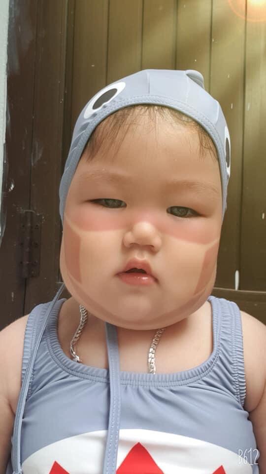 Xôn xao khắp Facebook: Xuất hiện nhiều em bé bị cháy nắng bá đạo, in hằn nguyên chiếc khẩu trang trên mặt, chuyện gì đang xảy ra?-5