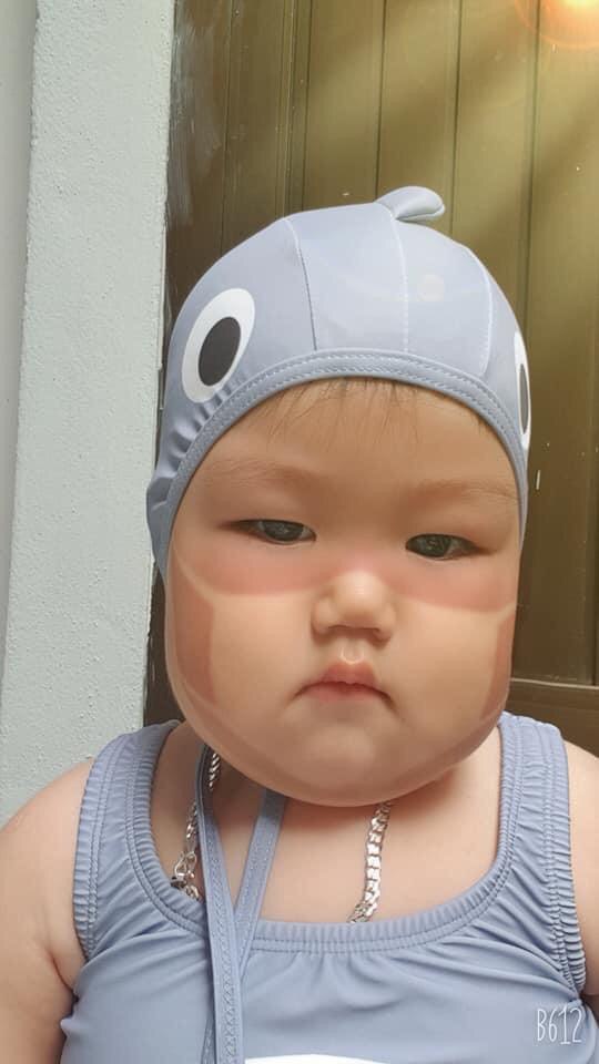 Xôn xao khắp Facebook: Xuất hiện nhiều em bé bị cháy nắng bá đạo, in hằn nguyên chiếc khẩu trang trên mặt, chuyện gì đang xảy ra?-6