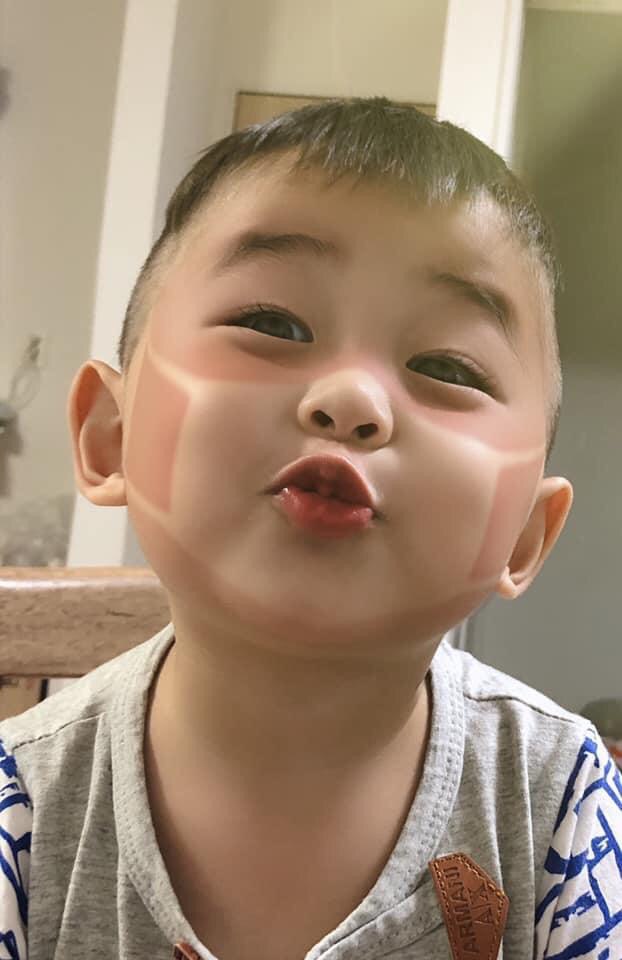 Xôn xao khắp Facebook: Xuất hiện nhiều em bé bị cháy nắng bá đạo, in hằn nguyên chiếc khẩu trang trên mặt, chuyện gì đang xảy ra?-7