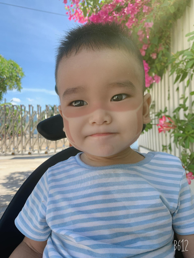 Xôn xao khắp Facebook: Xuất hiện nhiều em bé bị cháy nắng bá đạo, in hằn nguyên chiếc khẩu trang trên mặt, chuyện gì đang xảy ra?-9