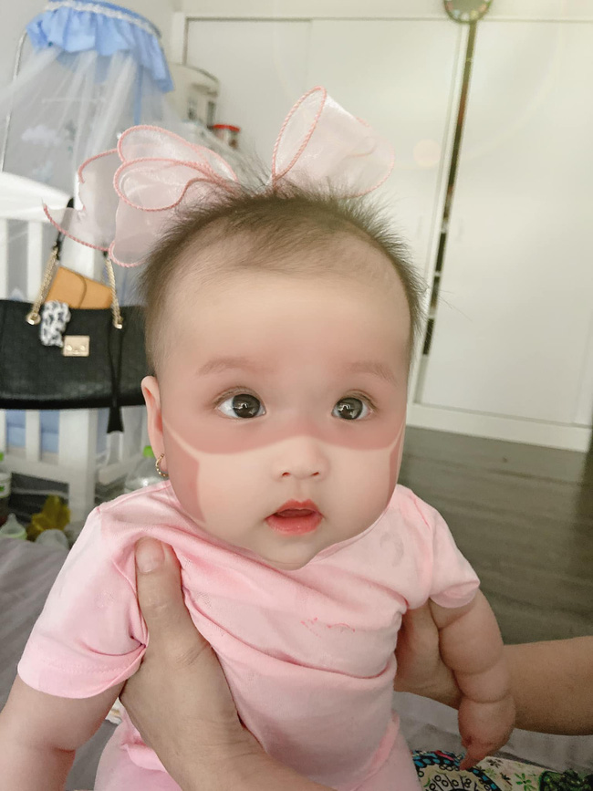 Xôn xao khắp Facebook: Xuất hiện nhiều em bé bị cháy nắng bá đạo, in hằn nguyên chiếc khẩu trang trên mặt, chuyện gì đang xảy ra?-10