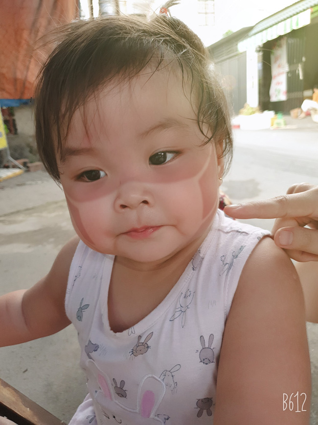 Xôn xao khắp Facebook: Xuất hiện nhiều em bé bị cháy nắng bá đạo, in hằn nguyên chiếc khẩu trang trên mặt, chuyện gì đang xảy ra?-11