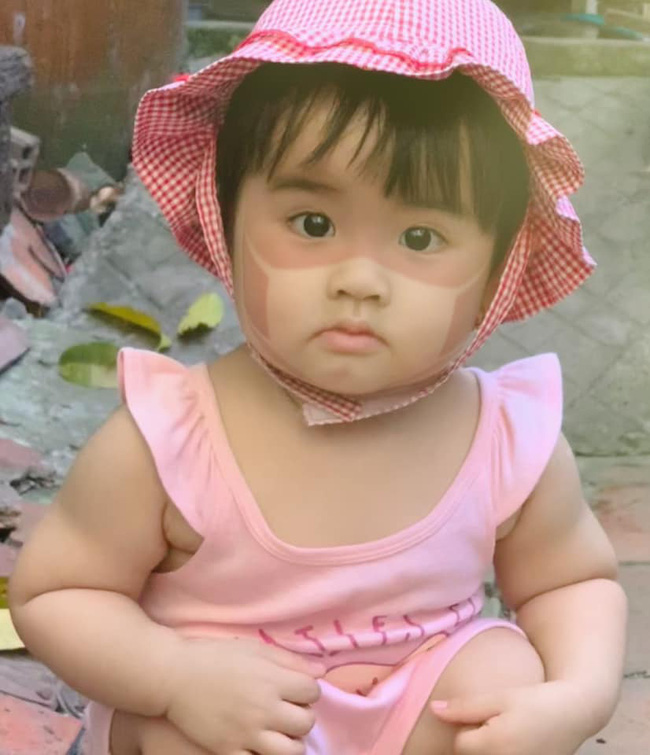 Xôn xao khắp Facebook: Xuất hiện nhiều em bé bị cháy nắng bá đạo, in hằn nguyên chiếc khẩu trang trên mặt, chuyện gì đang xảy ra?-12