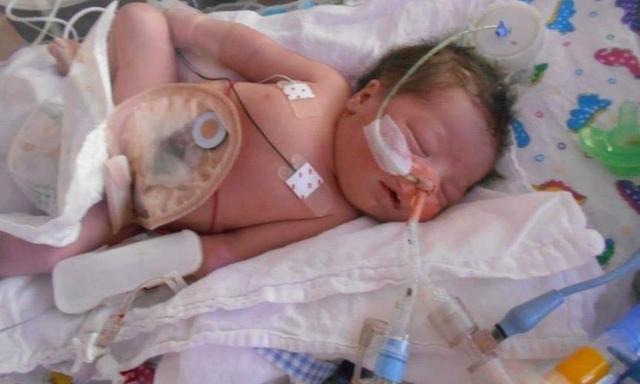 Đang háo hức chờ đón con đầu, bà mẹ chết đứng khi nghe bác sĩ siêu âm thông báo một tin khủng khiếp-2