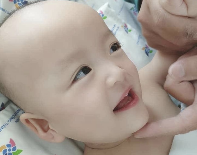 Rụng tim với khoảnh khắc Trúc Nhi - Diệu Nhi biểu cảm đáng yêu chụp hình với các bác sĩ sau hơn nửa tháng phẫu thuật-3