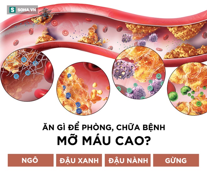 Cách đơn giản để xác định có bị mỡ máu hay không: Đừng bỏ qua mà nguy hiểm tính mạng-3