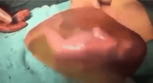 Đoạn clip khiến người xem không thể rời mắt: Em bé vừa sinh ra đã quậy tưng bừng, nhảy múa lộn nhào trong bọc ối-2