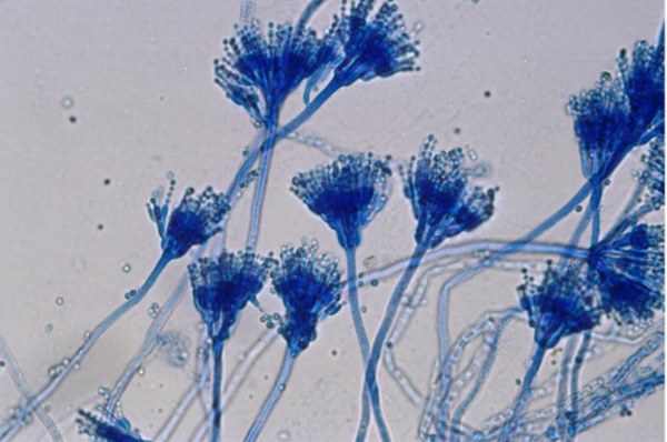 Những người cả đời không mắc ung thư thường có đủ 5 thói quen này: Hầu hết đều đã được WHO khuyến cáo nhưng không phải ai cũng biết để thực hiện-2