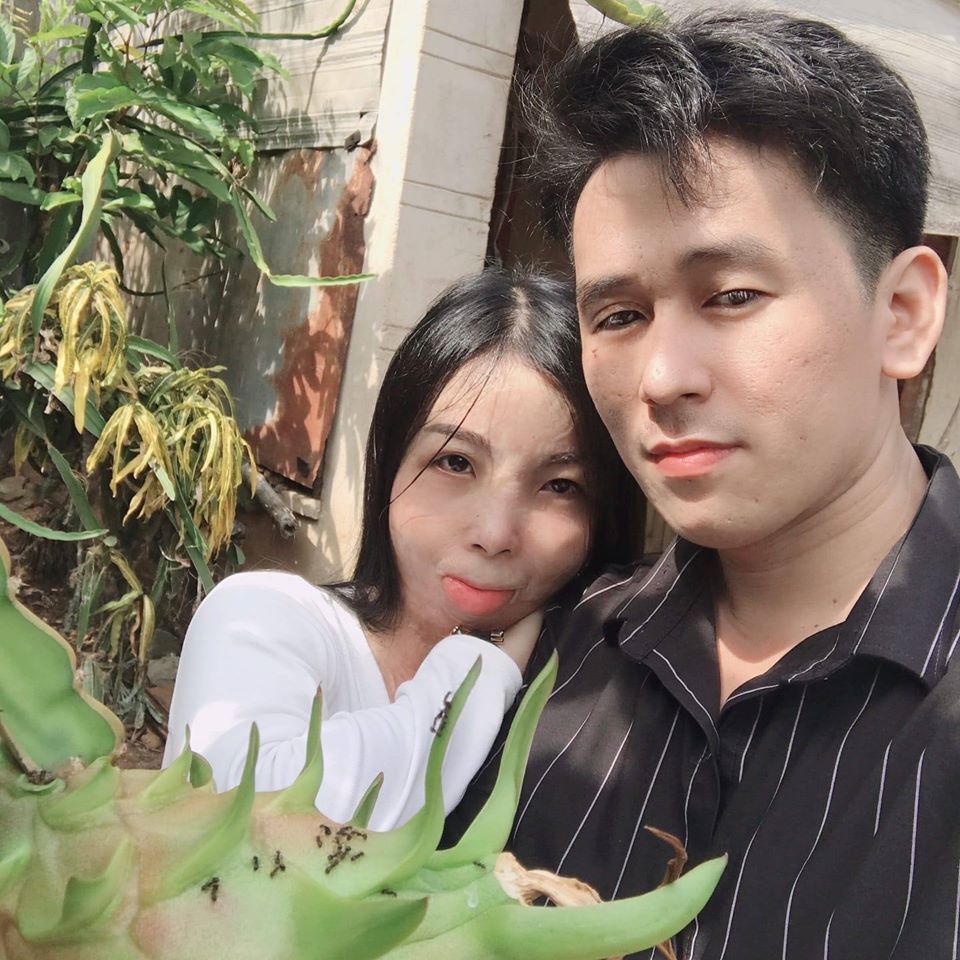 Câu chuyện đằng sau bức ảnh ông chồng điển trai và cô vợ biến dạng khuôn mặt: Khẳng định chủ quyền vào đúng ngày Cá tháng 4-3