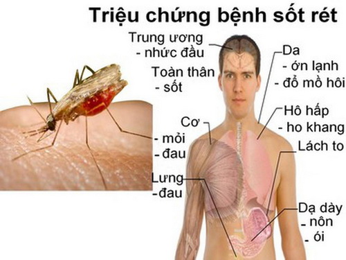 Nhiều bệnh nhân COVID-19 mắc thêm sốt rét, men gan gấp 15 lần, tổn thương nội tạng-3