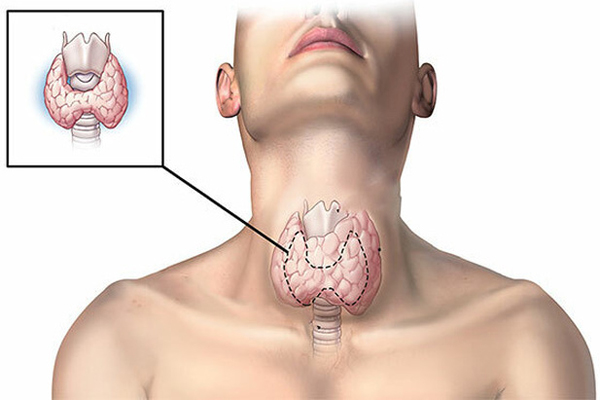 Ăn càng ít muối càng tốt cho sức khỏe? Hầu hết mọi người đều sai, bây giờ bạn biết cũng chưa muộn-3