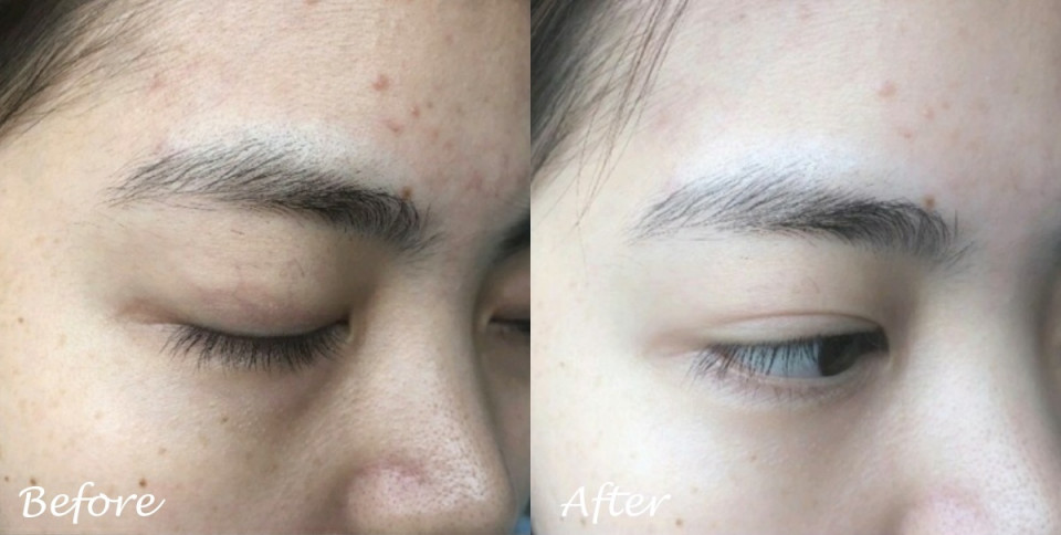 Ở tuổi 30 Ngụy Anh Lạc vẫn sở hữu làn da căng mịn như em bé nhờ áp dụng chế độ cai skincare học từ chuyên gia người Nhật-4