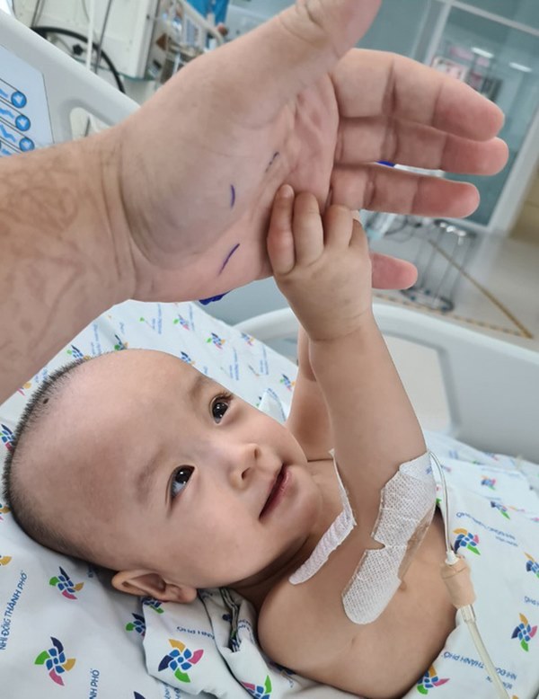 Chị em Trúc Nhi - Diệu Nhi tươi cười nắm lấy tay bác sĩ, dự kiến sẽ tập đi trong 6 tuần tới-2