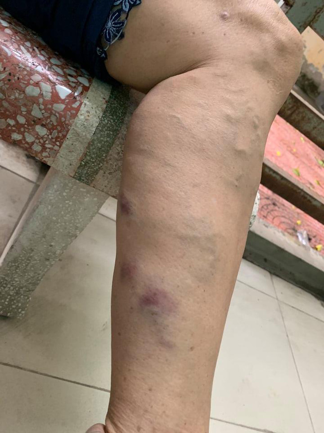 Nỗi kinh hoàng của 2 người phụ nữ lớn tuổi bị hàng chục đàn em của giang hồ mạng Phú Lê bủa vây-3