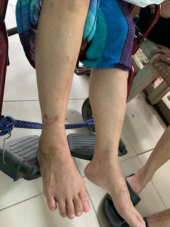 Nỗi kinh hoàng của 2 người phụ nữ lớn tuổi bị hàng chục đàn em của giang hồ mạng Phú Lê bủa vây-1