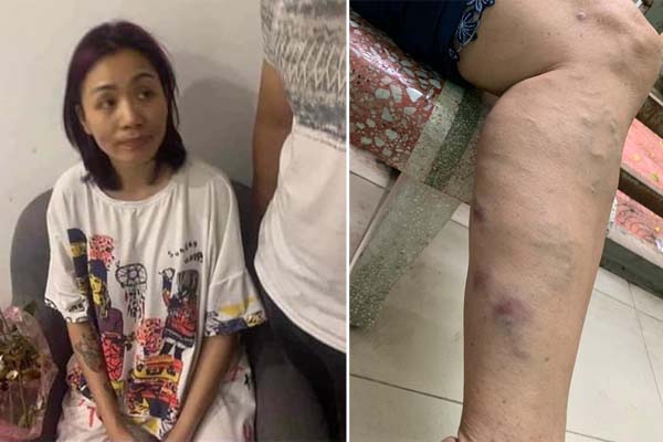 Vợ chồng Phú Lê thừa nhận liên quan vụ đánh đập 2 phụ nữ-2