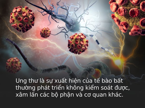Loại ung thư mà người giàu và người nghèo dễ mắc nhất là gì? Câu trả lời sẽ khiến bạn phải thay đổi thói quen sống gấp-1