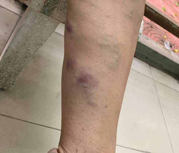 Mẹ của Đào Chile kể lại giây phút bị hai kẻ lạ mặt đánh gục tại nhà, còn bị đe doạ: Bảo con gái mày đừng động đến anh chị tao”-6