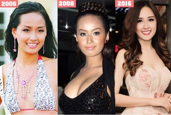 Mai Phương Thuý thừa nhận phẫu thuật thẩm mỹ, ghi tên vào hội Hoa hậu lên đời nhờ dao kéo-1