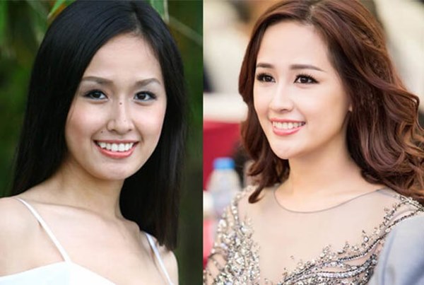 Mai Phương Thuý thừa nhận phẫu thuật thẩm mỹ, ghi tên vào hội Hoa hậu lên đời nhờ dao kéo-2