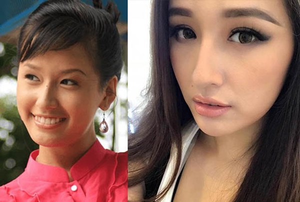 Mai Phương Thuý thừa nhận phẫu thuật thẩm mỹ, ghi tên vào hội Hoa hậu lên đời nhờ dao kéo-3