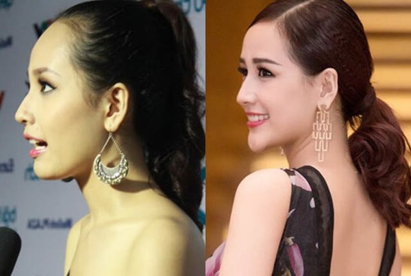 Mai Phương Thuý thừa nhận phẫu thuật thẩm mỹ, ghi tên vào hội Hoa hậu lên đời nhờ dao kéo-4