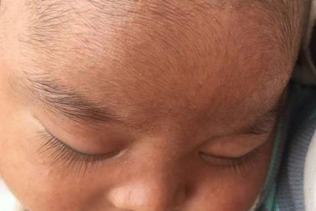 Tưởng con sinh ra đột biến gen” đen xì, 2 tháng sau ngoại hình thay đổi một trời một vực-3