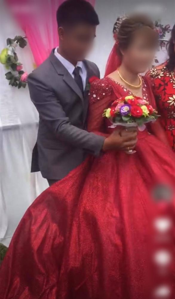 Chú rể liên tục lấy váy cô dâu che chắn khi chụp hình, ai dè giấu giếm một bí mật” đằng sau-2
